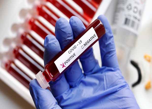 দেশীয় প্রযুক্তিতে তৈরি নয়া করোনা কিট