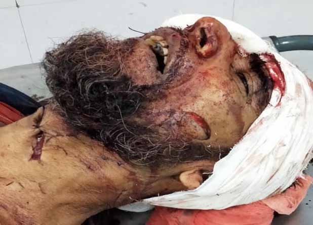 CPI(M) party member Brutally Murdered at Raidighi