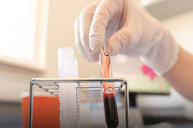 দিল্লিতে সফল প্লাজমা থেরাপির প্রয়োগে সুস্থ হয়ে উঠলেন করোনা আক্রান্ত!